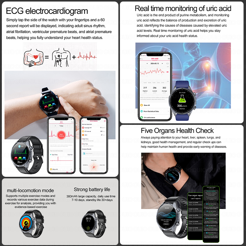 สมาร์ทวอทช์รุ่นใหม่ปี 2026 อัป - Smartwatch Watches For Women Branded บทวิจารณ์และราคา